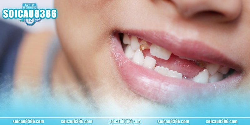 Góc nhìn tâm linh để hiểu nằm mơ thấy rụng răng là điềm gì?